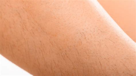Excessive Hair Growth - Institut Figurra