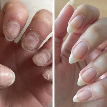 UltraGrow Nail Serum - Liaison Growth