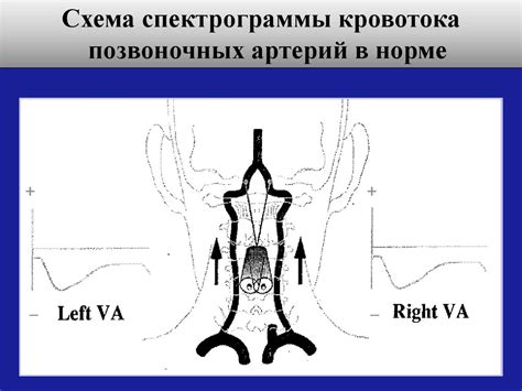 Позвоночные артерии - презентация онлайн
