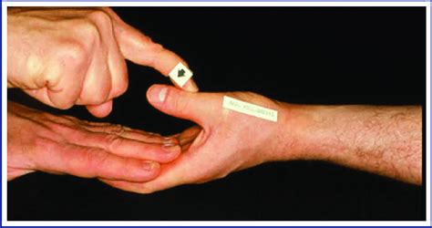 Testing of the APB muscle. | Download Scientific Diagram