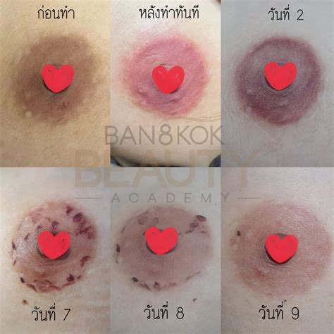 how to make your areola smaller at home