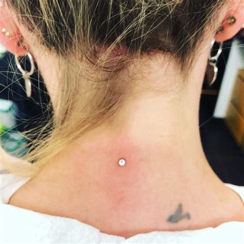 O Que É Microdermal