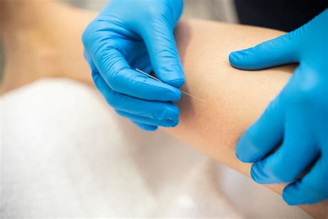 Dry Needling vs. Acupuncture: Main Differences and Similarities ...