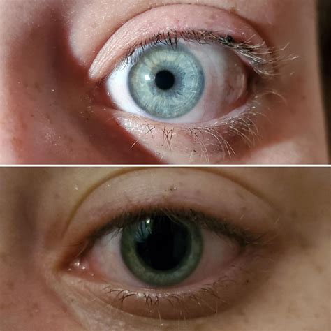 Collection 98+ Pictures P-shot Before And After Pictures Reddit Stunning
