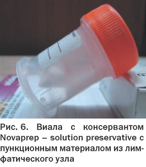 Жидкостная цитология. Качественный преаналитический этап ...