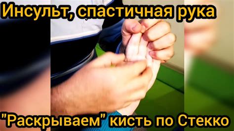 Инсульт, спастичная кисть (рука). Работа по Стекко в реальном времени ...