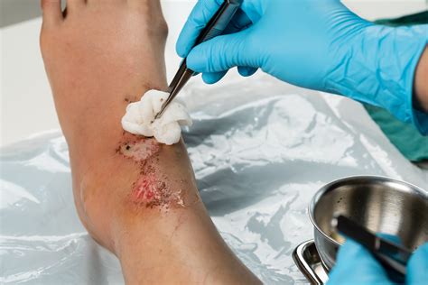 Detailed breakdown of the average crna nurse salary 15