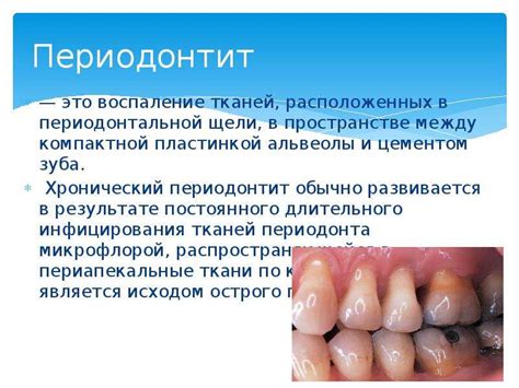 ПЕРИОДОНТИТ - скачать презентацию