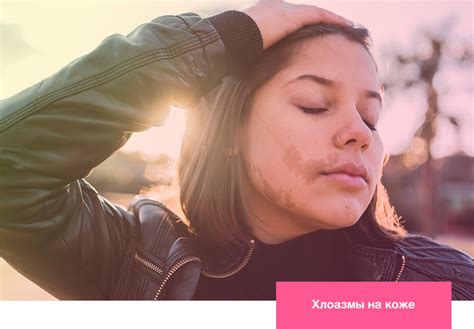 Лечение пигментных пятен