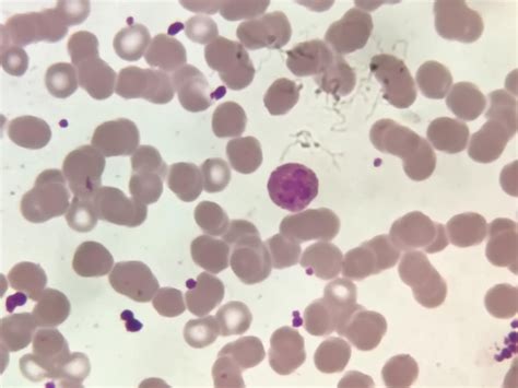 Premium Photo | Neutrophil cell in blood smear.