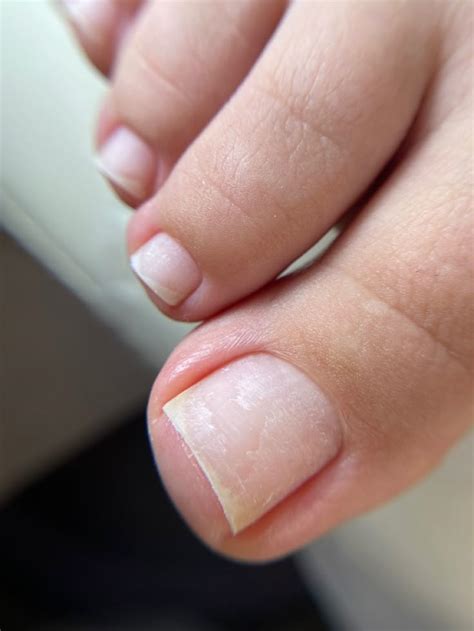 Педикюр | Disegni per unghie dei piedi, Unghie piedi, Idee per manicure