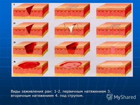 Презентация на тему: "Раны. Классификация. Характеристика раневого ...