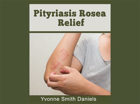Pityriasis Alba On Hands