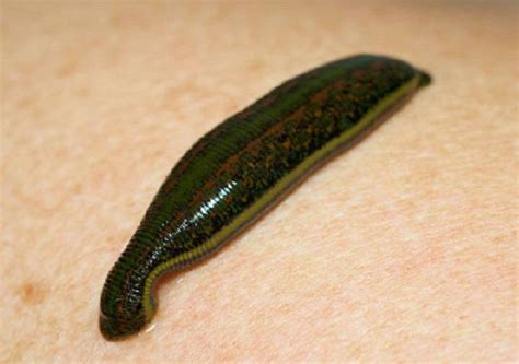 terapi lintah  kesehatan efektifkah klikdokter