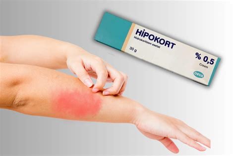 Hidrokortizon Kremi Yüzde 1