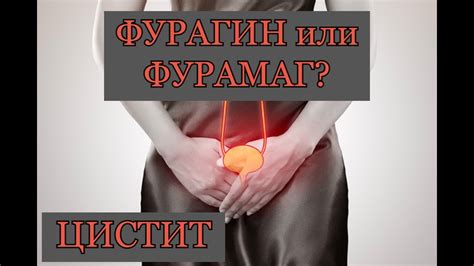 Фурагин или Фурамаг? Что лучше? - YouTube