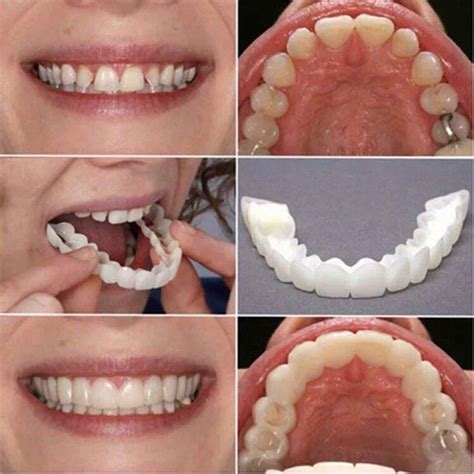 Magic Teeth Brace – Rabbit Quick