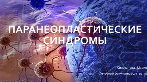 Паранеопластические синдромы - презентация онлайн