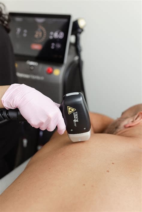 laser hair removal back 9