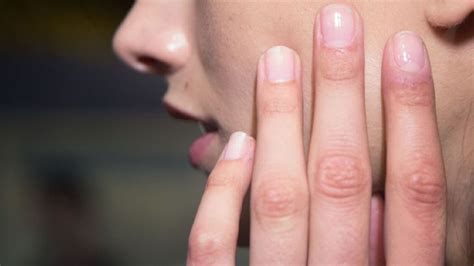 Top más de 60 imágenes sobre: porque tengo las uñas de las manos ...