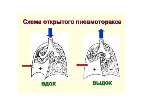 Закрытые повреждения мягких тканей - презентация онлайн