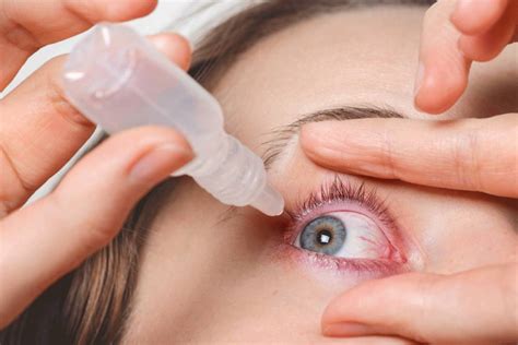 The Simple Ways To Treat Conjunctivitis At Home Naturally | All Info Geek