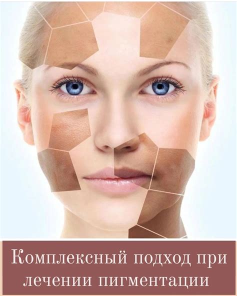 Комплексный подход при лечении пигментации - mediton