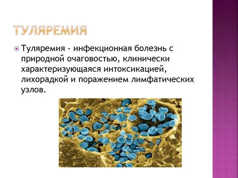 Возбудители бактериальных кровяных инфекций: туляремия - презентация онлайн