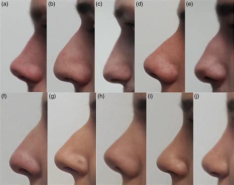 Most Beautiful Nose Shape