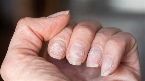 Here's what your fingernails reveal about the state of your health ...