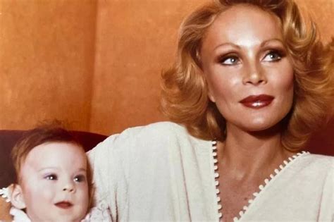 Catwoman Jocelyn Wildensteins real face before major plastic