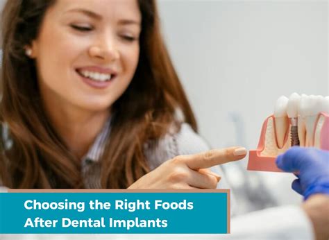 Choosing the Right Foods After Dental Implants - Thind