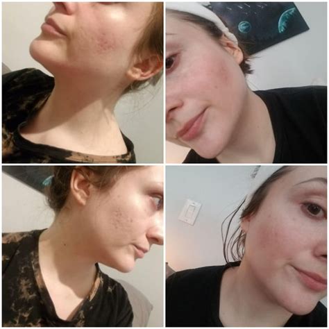 Tru Alchemy : SkincareAddicts