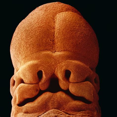 A Child is Born: Photographs of the foetus developing in the womb, by ...