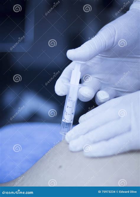 Intratissue Percutaneous Electrolysis EPI Stock Photo - Image of skin ...