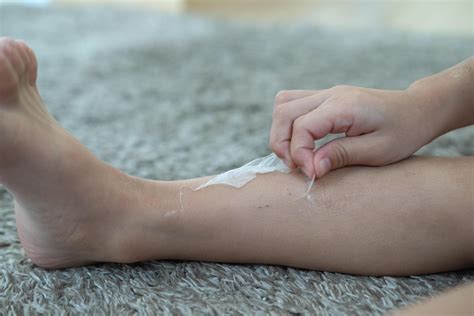Little Asian boy's hands peeling off dry skin on his legs. Skin