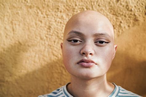 Which Vitamin Deficiency Causes Hair Loss In Kids - Infoupdate.org