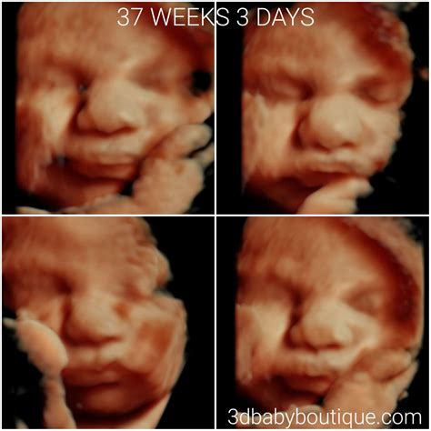 37 Weeks Pregnant 3d Ultrasound Pictures