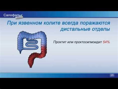 Салофальк гранулы - YouTube