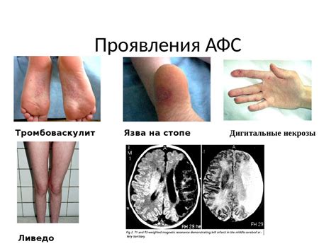 Системные заболевания соединительной ткани у детей - презентация онлайн