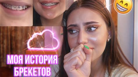 МНЕ СНЯЛИ БРЕКЕТЫ//до/после+ответы на вопросы - YouTube