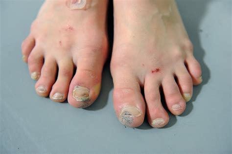 Clare Becker Photo: Dancer Feet