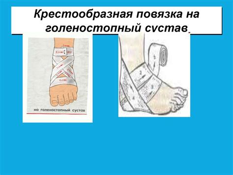 Первая помощь при ранениях и кровотечениях - презентация онлайн