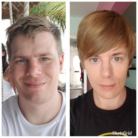 menopause hrt and hair loss 14