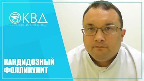 1414 Кандидозный фолликулит - YouTube