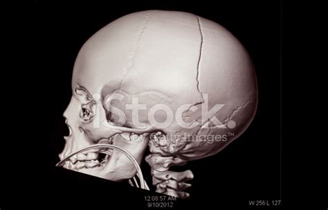 Mri Skull stock photos - FreeImages.com