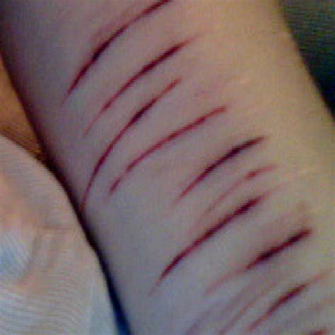 wrist cuts pictures
