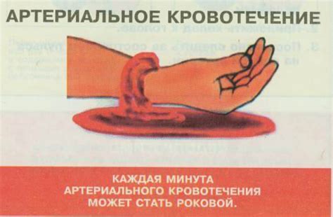 Виды кровотечений | lemur59.ru