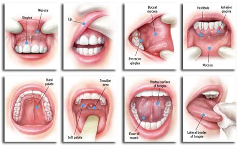 Oral Cancer: Causes, Symptoms, & Treatment - Philadelphia Dentistry