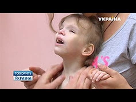 🔥 Синдром кошачьего крика ¦ Говорит Украина - YouTube